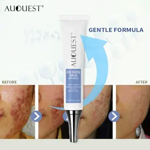 Acne Reparatie Huid Behandeling Anti Mee-eter Acne Litteken Gezicht Gel Crème