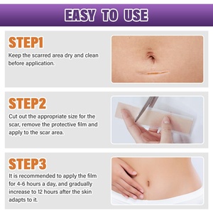 Label pribadi pita bekas luka Gel silikon penghilang bekas luka lama baru menghilangkan <span class=keywords><strong>keloid</strong></span> luka bekas luka bedah jerawat hiperrocker bekas luka - Product Image 6