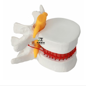 Modelo de Columna Vertebral Interlumbar Humana de Alta Calidad, Modelo Óseo para Enseñanza Médica - Product Image 2