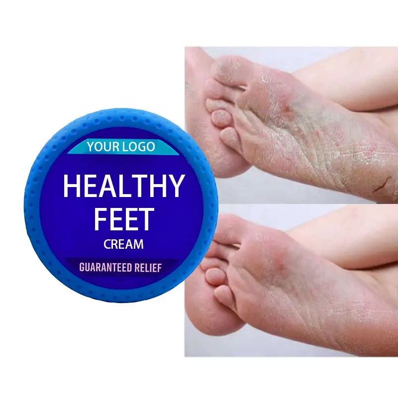 Super Concentrated Feet Cream Heals, Relieves & Repairs Extremely Dry, Cracked Hands/Foot