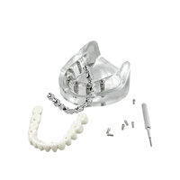 Modelo Anatómico de Implante Dental, 6 Implantes, Mandíbula Superior e Inferior, Restauración de Sobredentadura, Dientes Removibles, Educación, Estudio, Enseñanza