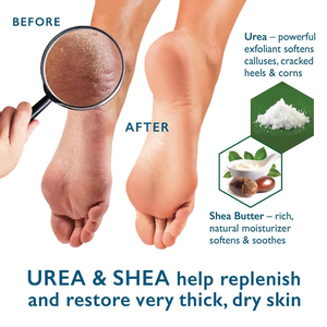 Marque privée Crème à l'urée 40% Acide salicylique 2% Crème pour les pieds à l'huile d'arbre à thé pour les talons craquelés secs Pieds Genoux Coudes Mains - Product Image 3