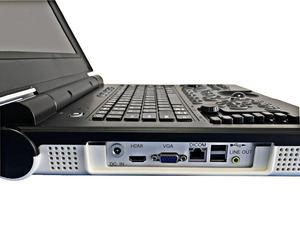 Expédition Rapide - Échographe Portable Chison - <span class=keywords><strong>Prix</strong></span> Compétitif - Instruments d'<span class=keywords><strong>Échographie</strong></span> Médicale - Acrylique - CE - Électrique - Product Image 4