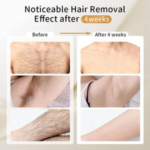 Moolweel-Depiladora <span class=keywords><strong>láser</strong></span> T001i con diodo para rejuvenecimiento de la piel, para uso doméstico, IPL, para hombres - Product Image 4