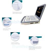 Échographe Doppler Couleur Portable RUISHENG N30 OB/GYN pour Diagnostic de Grossesse en Clinique et Hôpital