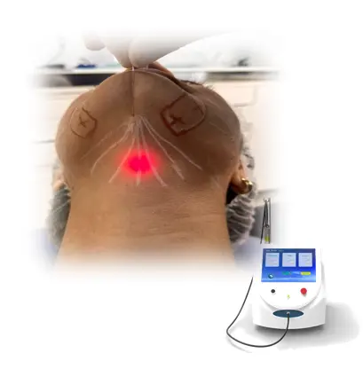 Lipolysis Diode Laser Fiber portabel, mesin medis Laser sedot lemak 1470nm + 980nm untuk operasi tubuh, pelangsing lemak