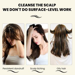 Pegatinas Personalizadas para el Cuidado del Cabello Orgánico, Exfoliante para el Cuero Cabelludo con Biotina y Ácido Salicílico, Tratamiento para la Caspa - Product Image 2