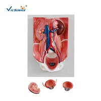 Modelo Anatómico del Sistema Urinario Humano, Modelo de Riñón, Uréter, Vejiga y Uretra para Enseñanza Médica en Urología, CE/ISO/ROHS/CNAS