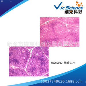 Thymus section, histology and embryology, animal and plant specimens, <b>microscopic</b> structure teaching aids - Product Image 5