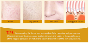 <span class=keywords><strong>Dermapen</strong></span> Recargable Dr. Pen, Potente Microneedle <span class=keywords><strong>Dermapen</strong></span> Ultima <span class=keywords><strong>M5</strong></span> - Product Image 3