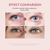 Crema Contorno de Ojos con Péptidos Rosados PDRN, Reduce Líneas Finas, Anti-Hinchazón, Ojeras, Crema Sérum Reafirmante