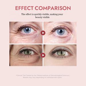 PDRNピンクペプチドアイクリームファーミング除去ファインライン防爆ダークサークル下目を引き締めるクリーム - Product Image 2