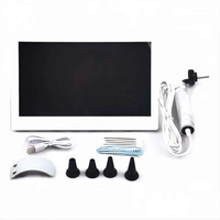 Examen de l'oreille portable écran LED affichage USB HD Otoscope vidéo numérique avec caméra