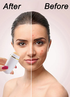 Vente chaude lavable naturel métal contrôle de l'huile visage rouleau absorbant l'huile visage pierre volcanique absorbeur d'huile rouleau de pierre volcanique