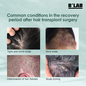 Purc — ensemble de traitement pour la repousse des cheveux, soins pour le cuir chevelu, crème réparante et apaisant pour la chevelure, - Product Image 4