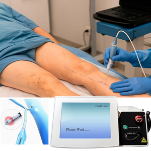 Eliminación de Venas Varicosas con Láser EVLT de 1470nm, Ablación Láser Evla, Flebología Endovascular Mini-Invasiva - Product Image 1