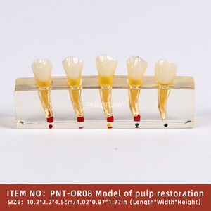 PNATOMY, modelo terapéutico patológico Dental de 5 componentes, muestra lesiones de caries, pulpa necrótica, absceso apical de plástico - Product Image 2