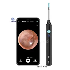 LANNX uENT V6B sıcak satış şarj Earpick temizleyici kaşık earpick aracı kulak balmumu çıkarıcı ile Led ışık kablosuz görsel kulak temizleyici