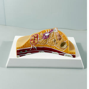 Modelos de Patología de Lesiones Mamarias y Lobos de Conductos Mamarios Anatómicos Humanos MAC-YJ57 PVC MAXCARE - Product Image 1