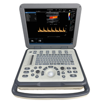 Échographe Doppler Couleur Ergonomique VS-BN60 avec Écran LCD 15 Pouces pour l'Abdomen, l'Obstétrique et la Gynécologie