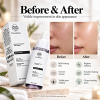 Solution exfoliante aux acides AHA BHA fermentés, acide glycolique et salicylique, exfoliation en 10 minutes, affinant les pores, éclaircissant, sérum pour le visage