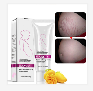 Private Label Mango smagliature cicatrice cicatrice guarigione <span class=keywords><strong>crema</strong></span> <span class=keywords><strong>per</strong></span> rimozione unguento <span class=keywords><strong>per</strong></span> la vecchia cicatrice - Product Image 1