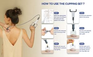 2024 prodotto caldo DropShipping 24 pezzi Set di terapia per coppettazione Hijama coppettazione Set di medicina tradizionale cinese per coppettazione - Product Image 3