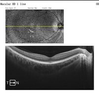Équipement ophtalmologique à succès : Tomographe OCT optique Oct-500 – Prix compétitif