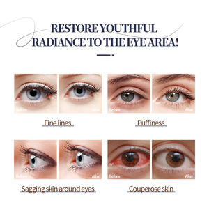 Crème Contour des <span class=keywords><strong>Yeux</strong></span> à l'Acide Hyaluronique Sodium Hyaluronate <span class=keywords><strong>Huile</strong></span> <span class=keywords><strong>d</strong></span>'<span class=keywords><strong>Olive</strong></span> Hydratant Raffermissant Fine Line Smoothing Under Eye Care Cream - Product Image 5