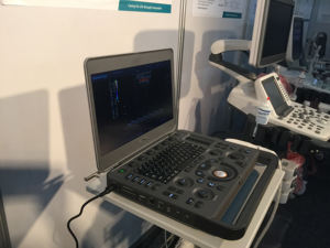 Échographe portable Sonoscape, fonction Doppler, <span class=keywords><strong>scanner</strong></span> portable Sonoscape <span class=keywords><strong>Ultrasonic</strong></span> X3 - Product Image 2