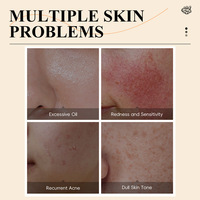 Kit de Soins Quotidiens Personnalisé OEM au Curcuma et à la Vitamine C pour Éliminer les Taches Noires et Réduire l'Acné, Lot de 5 Pièces