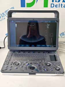 Échographe Doppler Couleur Portable Zoncare M30 avec Imagerie Élastographique pour Examen Cardiaque et Réproductif Vétérinaire - Product Image 4