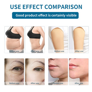 Máquina Portátil de Masaje Corporal SPA 40k para Quemar Grasa, Anticelulitis, Reducción de Celulitis y Escultura Corporal - Product Image 2
