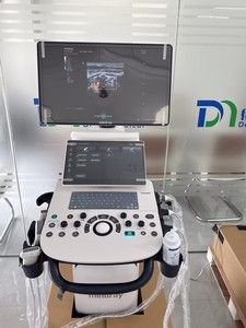 Échographe Doppler Couleur 3D/4D Mindray Consona N5T pour Obstétrique/Gynécologie avec Smart Face et Smart OB pour Diagnostic Pré-Natal - Product Image 2