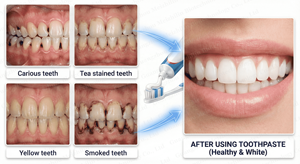 <span class=keywords><strong>Dentifrice</strong></span> éclaircissant à la niacinamide, vente chaude, <span class=keywords><strong>triple</strong></span> <span class=keywords><strong>action</strong></span>, éclaircissant, fraîcheur buccale et élimination des taches, <span class=keywords><strong>dentifrice</strong></span> à double tonifiant - Product Image 4
