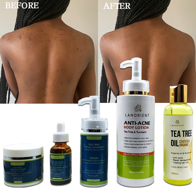 LANORIENT the Latest Natural Organic Tea Tree Korean Skin Care Product Vitamin C Acne Removal Skin Care Set for All Skin Types