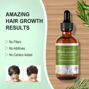 Private Label Women Black Hair Care Products Rosemary Oil Hair Growt Natural Organic Rosemary Essential Oil