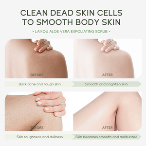 LAIKOU Aloe Vera Scrub corpo con pacchetto di vendita al dettaglio particelle naturali smerigliate rimuovere pelle ruvida pelle d'oca - Product Image 3