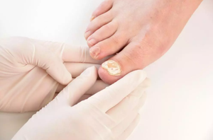 980nm Diodo Láser Equipo Podología Uñas Hongo Onicomicosis Láser - Product Image 6