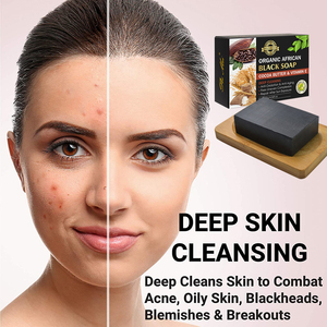Jabón orgánico limpiador de piel con extracto natural de plantas, jabón artesanal, exfoliación suave, jabón negro africano - Product Image 5
