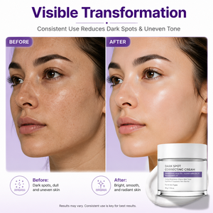Crema Facial OEM ODM para Desvanecer Manchas Oscuras, Pecas, Imperfecciones, Pigmentación, Reafirmante, Hidratante, Niacinamida, Antienvejecimiento, Arbutina, Ácido Tranexámico - Product Image 4