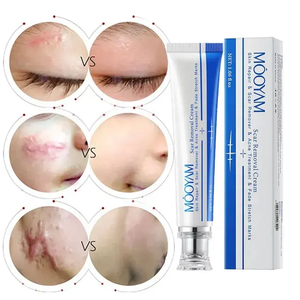 เจลสมุนไพรซ่อมแซมผิว OEM/ODM, ครีมลดรอยสิวและรอยแผลเป็นจากธรรมชาติ, รักษารอยแตกลายเพื่อผิวเรียบเนียน - Product Image 2