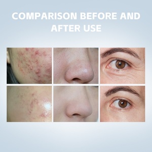 Máquina Facial de Oxígeno 7 en 1, Hidro-Oxígeno, Potente, con Nano Spray, Instrumento de Belleza - Product Image 6
