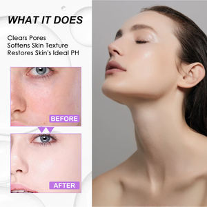 โทนเนอร์เช็ดหน้า150มล. สำหรับผิวแห้งและหมองคล้ำฉลากส่วนตัว - Product Image 5