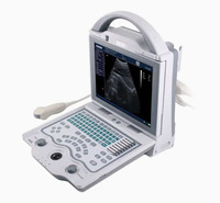 Ophtalmique ab Scan Machine à ultrasons Sonomed Scanner ophtalmique Échographie AB Scan Sonomed Eye