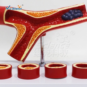 Modelo de Trombosis, Modelo Anatómico de <span class=keywords><strong>Arteriosclerosis</strong></span> Cardiovascular Humana - Product Image 2