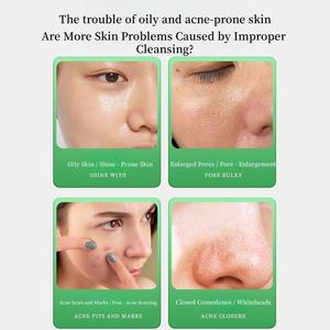 Productos para el cuidado de la piel a granel de fábrica para el tratamiento del removedor del acné Suero Anti Acné Parche de espinillas Acné para el cuidado facial de las espinillas - Product Image 3