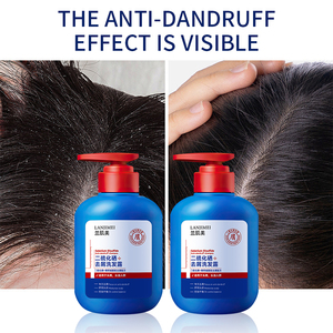 Tùy chỉnh bán buôn chống gàu dầu gội đầu axit amin hữu cơ chống rụng tóc <span class=keywords><strong>Selenium</strong></span> disulfide dầu gội đầu - Product Image 5