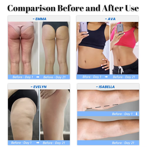 Masajeador Eléctrico Inalámbrico 2025 para Quemar Grasa Abdominal, Ventosas de Succión al Vacío, Adelgazamiento Facial, Escultura Corporal, Quema de Grasa, Anticelulitis - Product Image 6