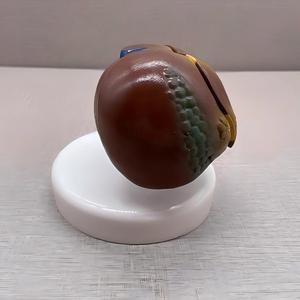 Modèle pédagogique biologique de pathologie hépatique avec base - Outil de démonstration anatomique pour l'enseignement de la hépatologie - Product Image 5